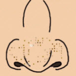 NoseOil(挤黑头(Squeeze Nose Pore Nyurutto)游戏汉化版)