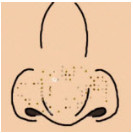 NoseOil挤黑头小游戏安卓版